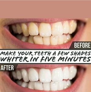 2 Ultimate White Tooth Whitening Powders